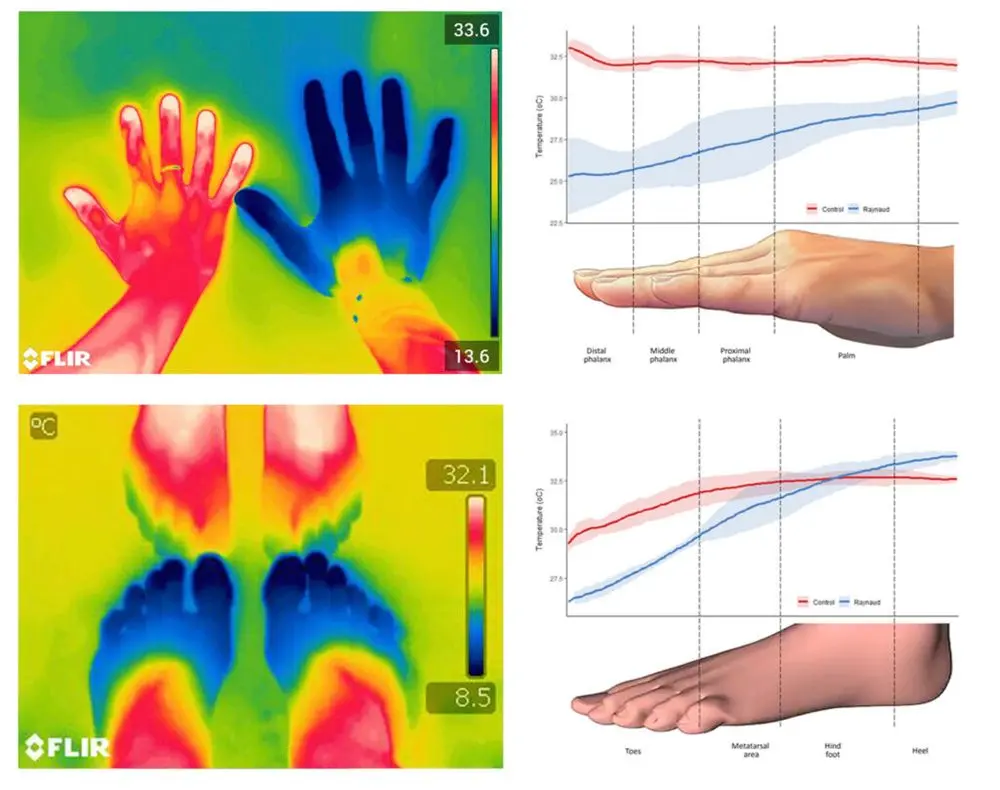 Woods Wellness Centre welcomes Anodyne Infrared Therapy - Woods Wellness Centre